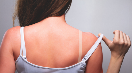 Why Am I Still Getting Sunburned After Using Sunscreen?